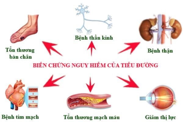 bien-chung-cua-benh-tieu-duong
