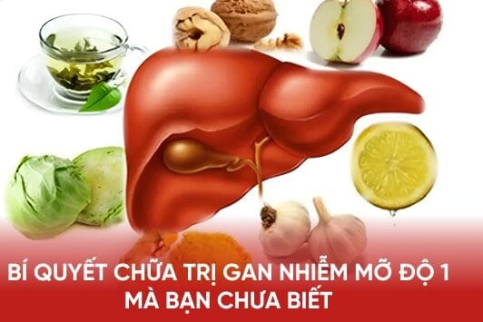Gan nhiễm mỡ nhẹ có chữa khỏi được không?