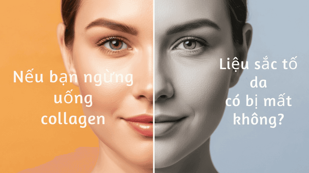 lo-so-phu-thuoc-collagen