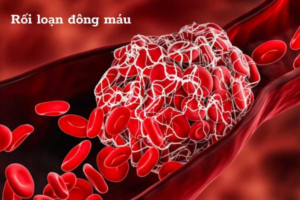 roi-loan-dong-mau